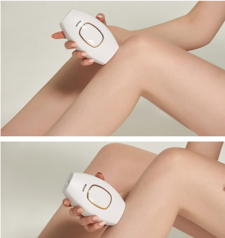 Electric Hair Removal Equipment